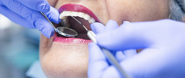 Best Emergency Treatment for Dental Infections or Abscesses in East Glenville, NY